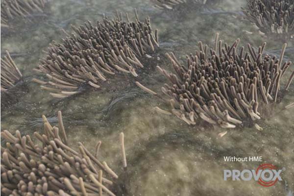 喉摘後:気管呼吸