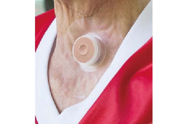 人工の鼻呼吸で取り戻す